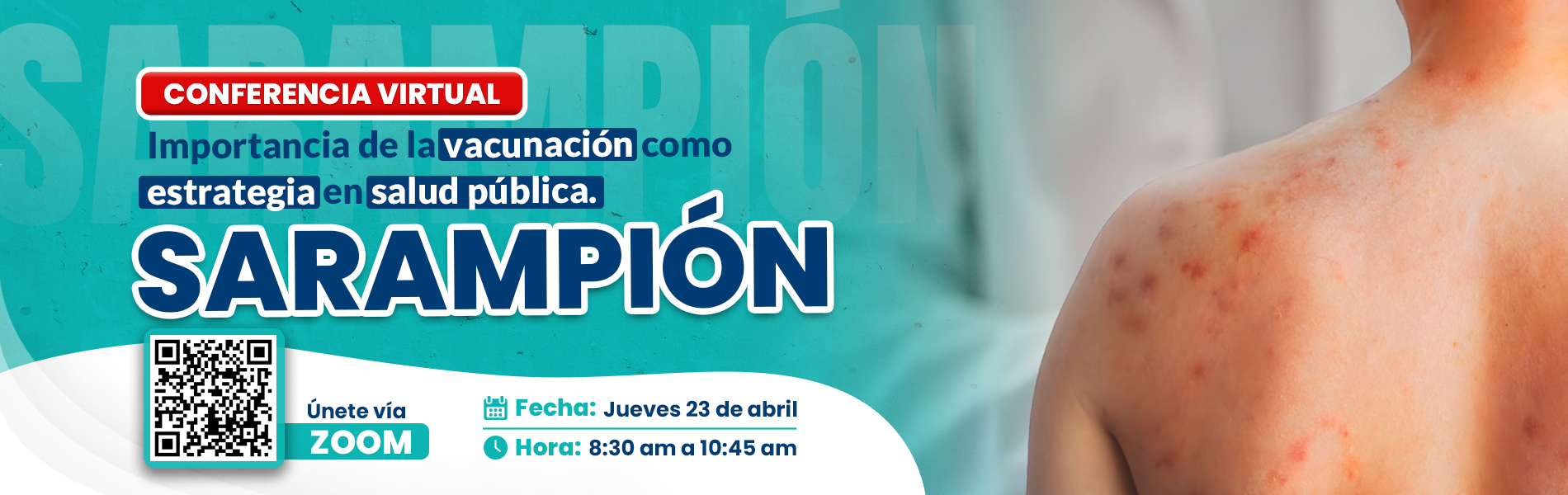 Conferencia virtual - Sarampión